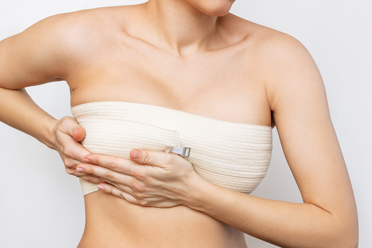 woman after breast augmentation in Los Gatos